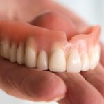 Guide to Snap-On Dentures