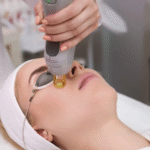 cosmetic lasers hamilton square