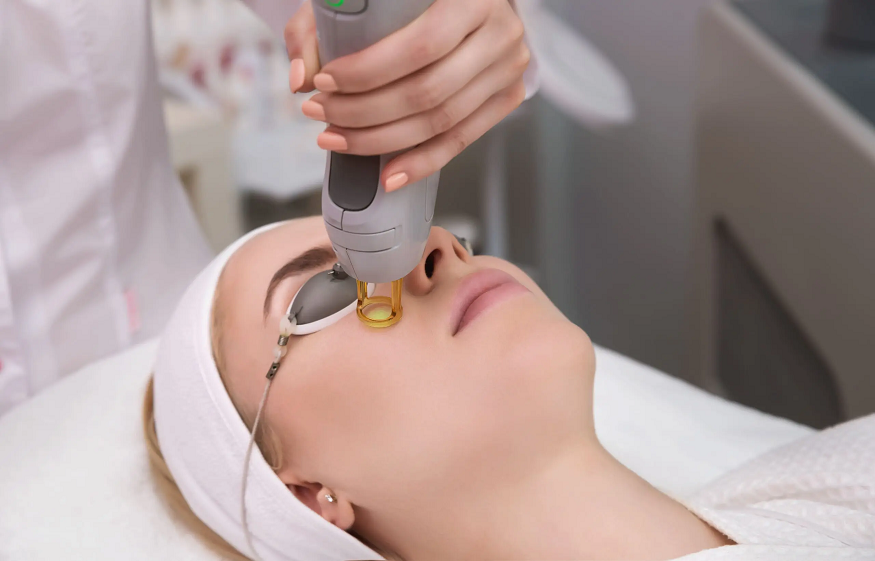 cosmetic lasers hamilton square
