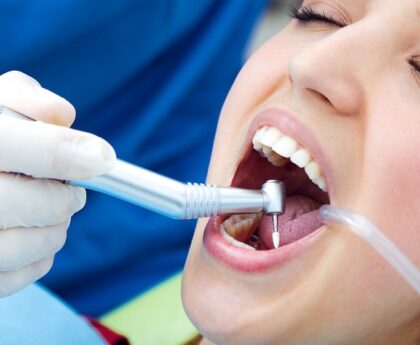 specialized root canal therapy